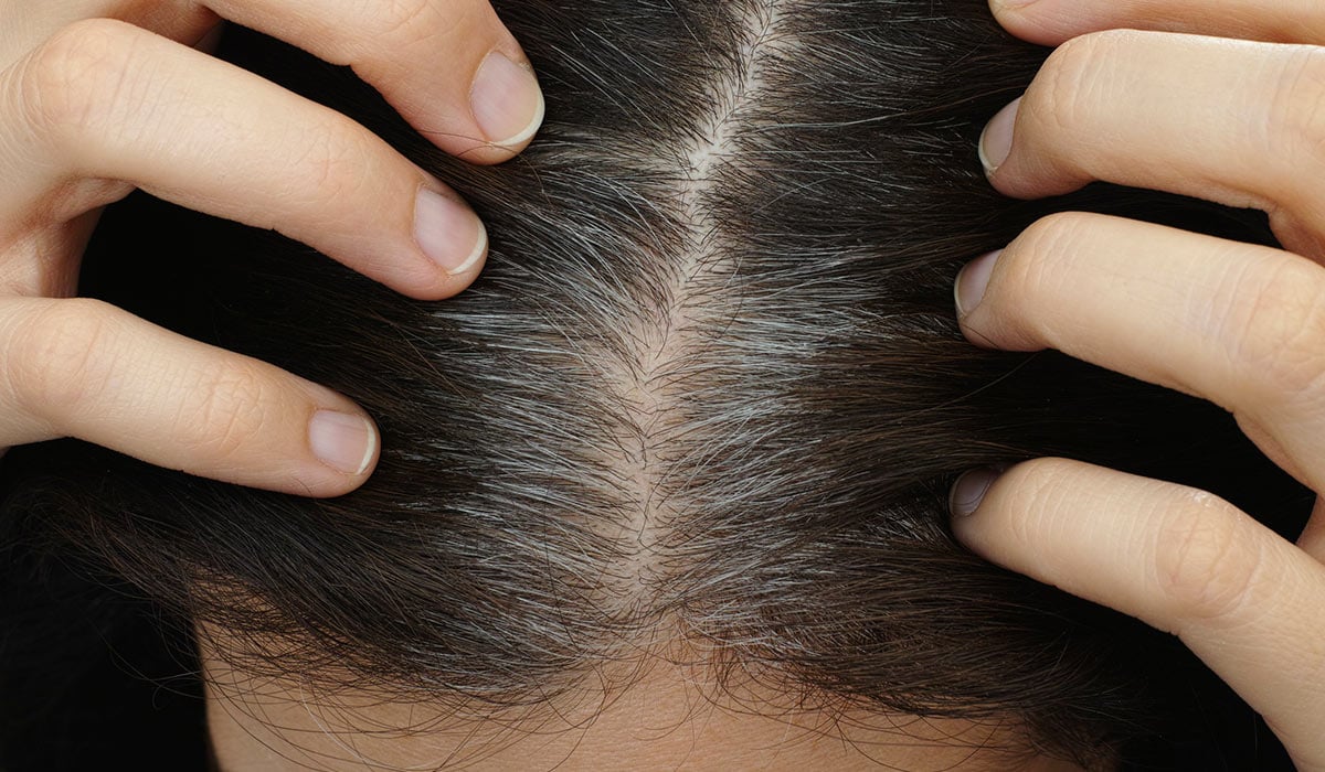 Κάλυψη λευκών μαλλιών χωρίς βαφή: Θεραπεία με φυσικό τρόπο ή βότανα